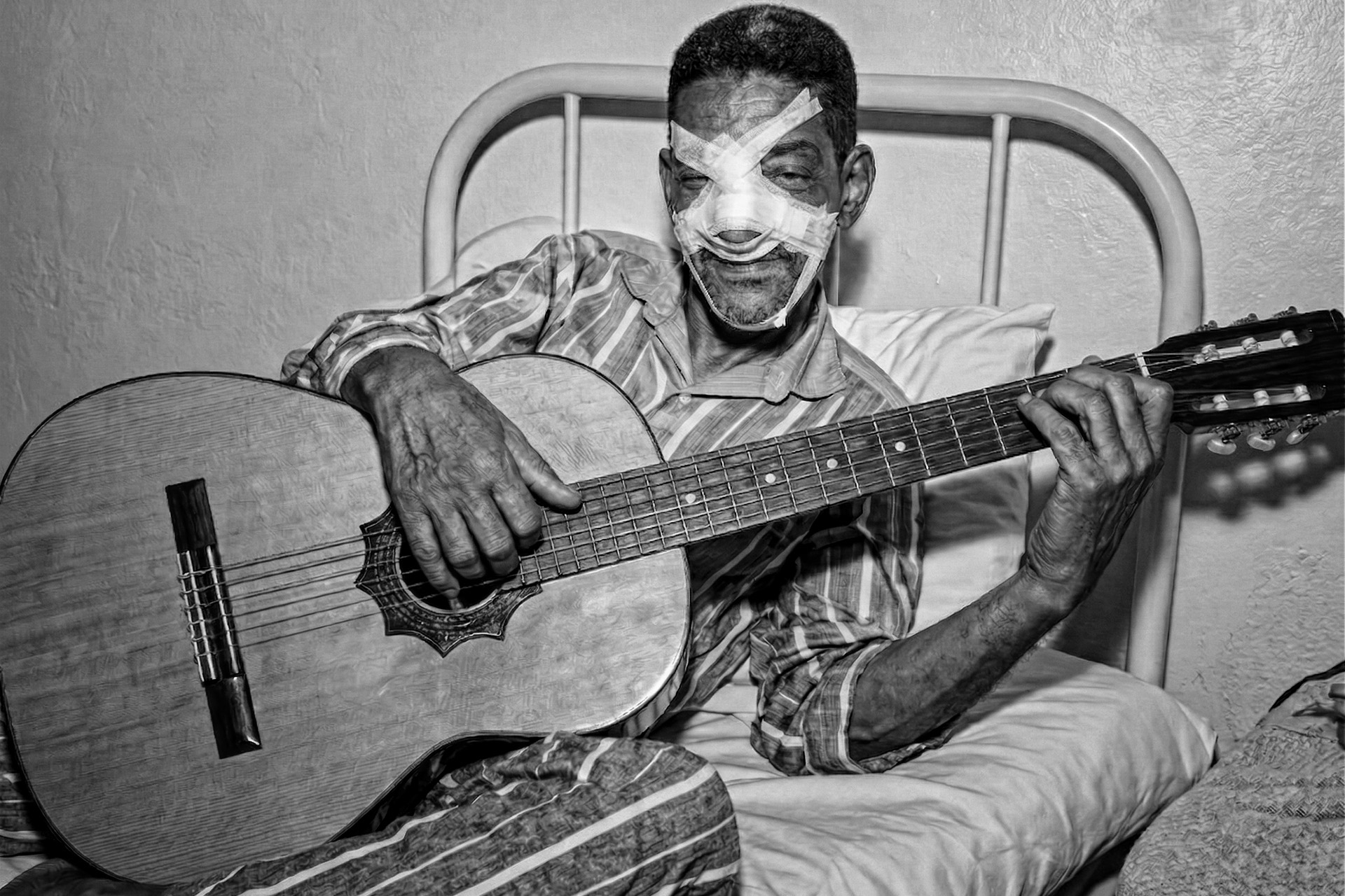 Cartola da Mangueira de pijama listrado tocando violão na cama do hospital com o rosto enfaixado, sorrindo